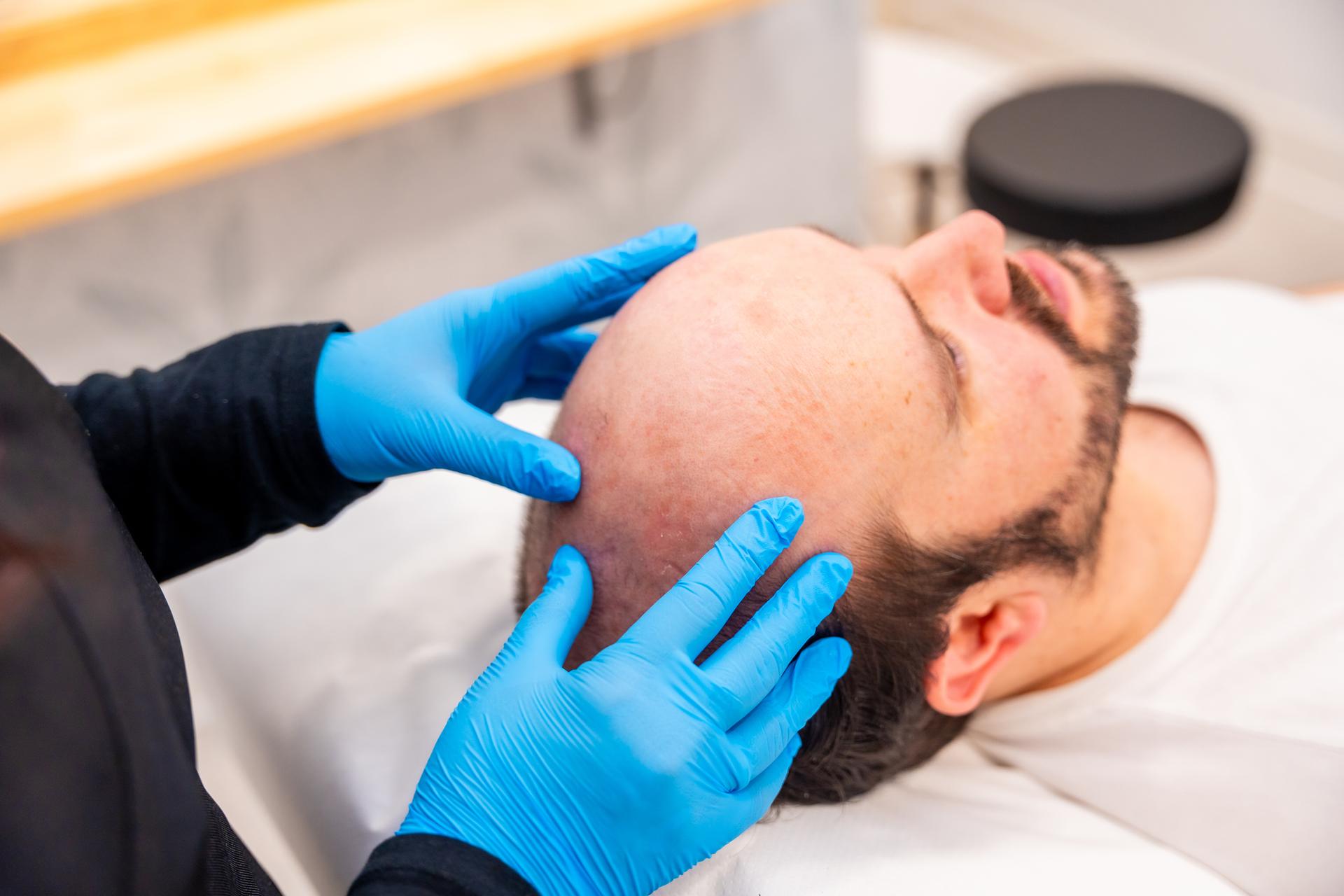 Doctor specialist in baldness checking a patient with hair loss